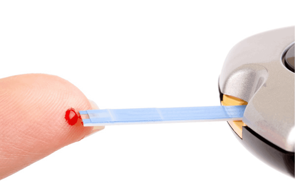 Can a Blood Test for Carpal Tunnel Confirm It?