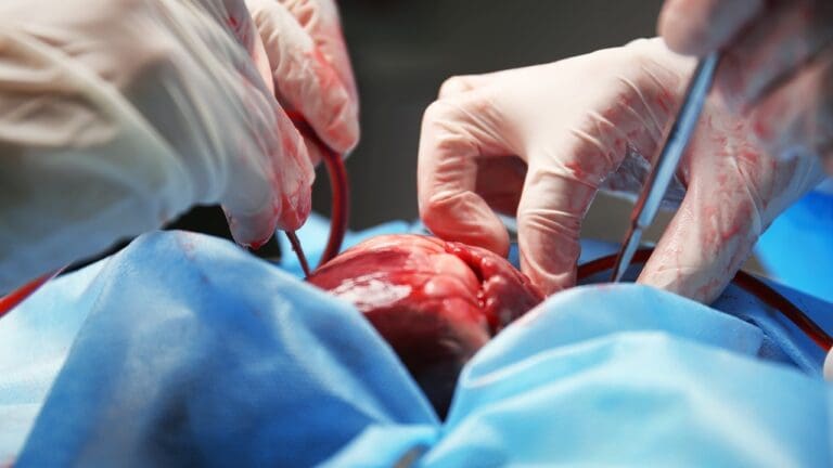 What Is the Best Option: Heart Valve Repair or Replacement Surgery?