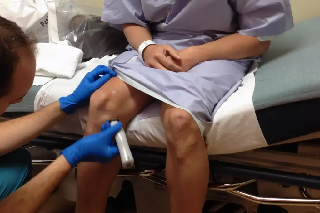 use ice after knee replacement