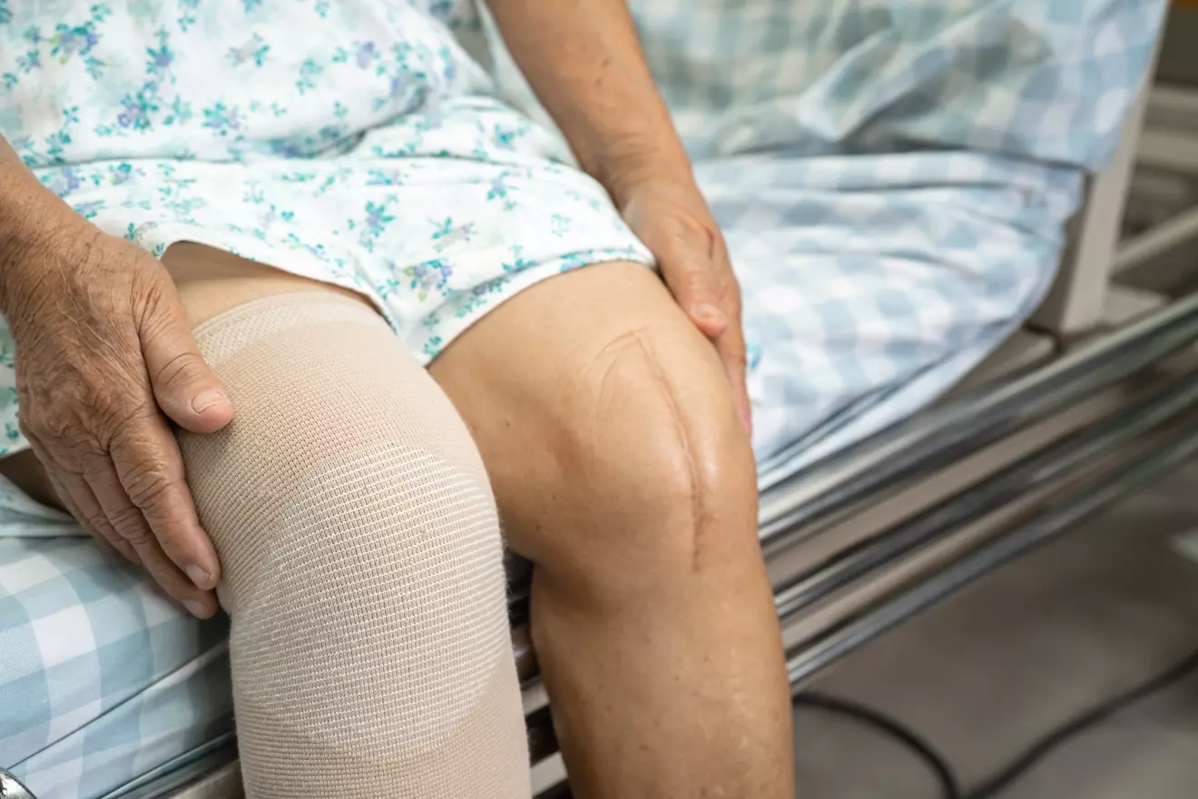 When Is It Safe to Use Heat After Knee Replacement and How Should You Do It?