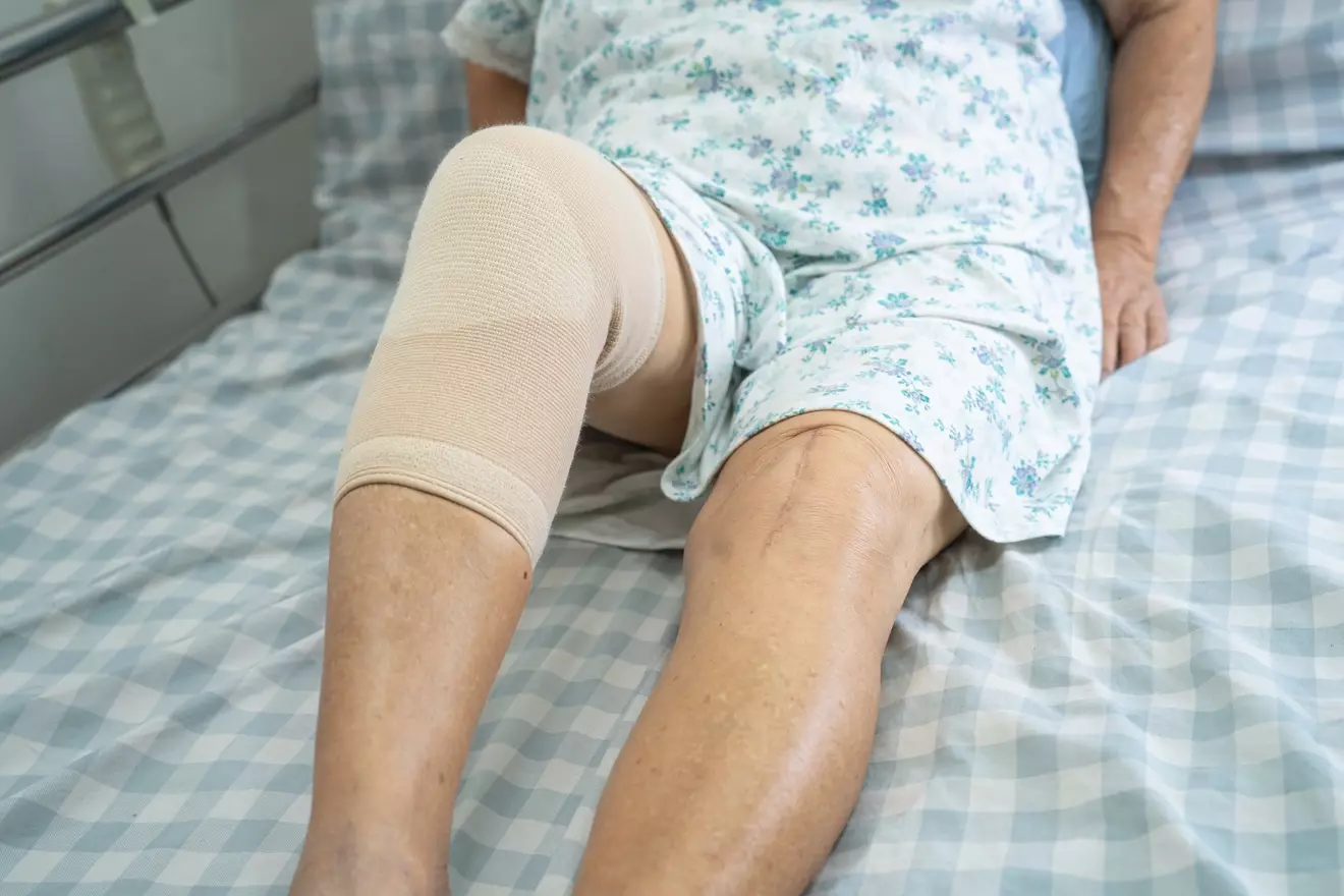 When Can You Safely Use Heat After Total Knee Replacement Surgery?