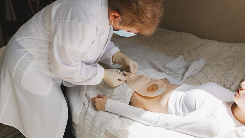 Do You Need a Bag After Prostate Removal? What to Expect During Recovery 1 Do You Need a Bag After Prostate Removal? What to Expect During Recovery