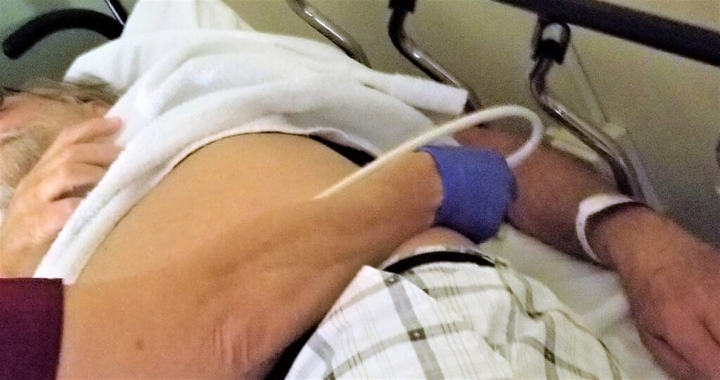 How Soon Can I Exercise After Prostate Surgery? Practical Recovery Guidelines