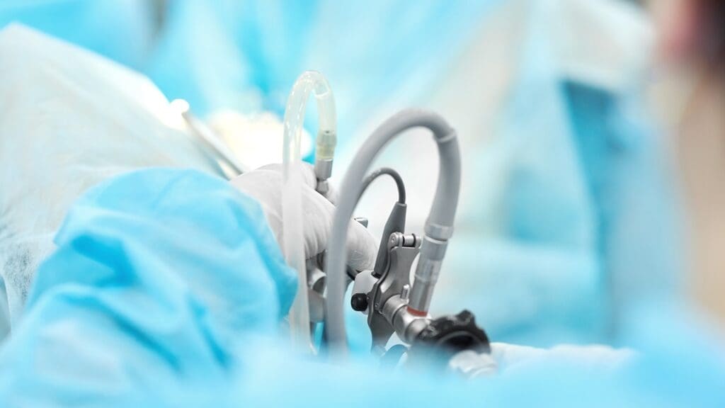 robotic-assisted laparoscopic radical prostatectomy