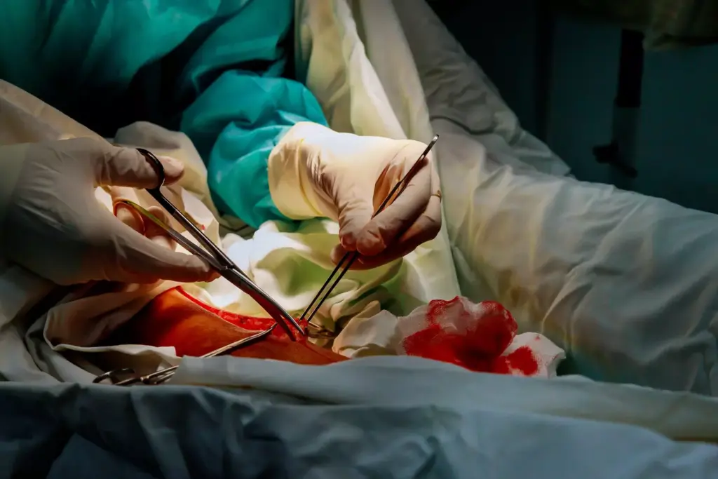 The Rich History of CABG Surgery