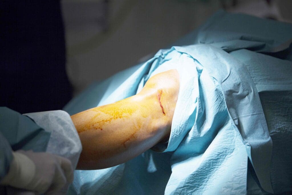 A bright, well-lit surgical theater with a patient's partially exposed knee, the skin cleanly shaved and disinfected