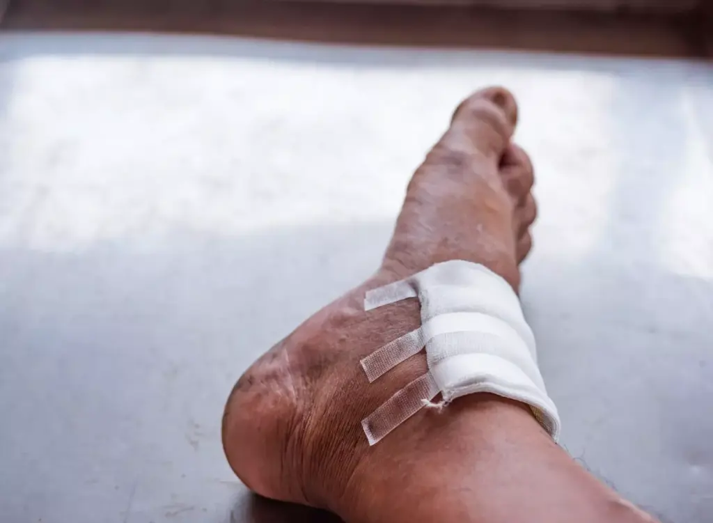 A detailed anatomical cross-section of a human knee joint, exposing a torn ligament. The foreground shows the ligament fibers in a frayed, distorted state, with the surrounding joint capsule and synovial membrane visible. The middle ground features the tibia, fibula, and femur bones in high detail, with their articulating surfaces and joint spaces clearly defined. The background softly fades into an abstract, clinical atmosphere, with muted hues and subtle grid-like patterns, evoking a sense of medical examination. Crisp, high-contrast lighting casts dramatic shadows, highlighting the structural integrity of the joint components and the traumatic nature of the injury. A technical, yet visually engaging depiction of a torn knee ligament, suitable for educational and medical illustration purposes.