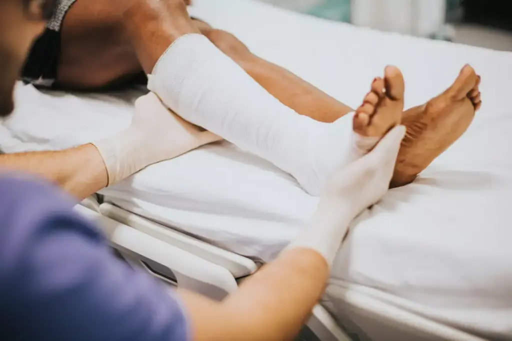 when to have bunion surgery