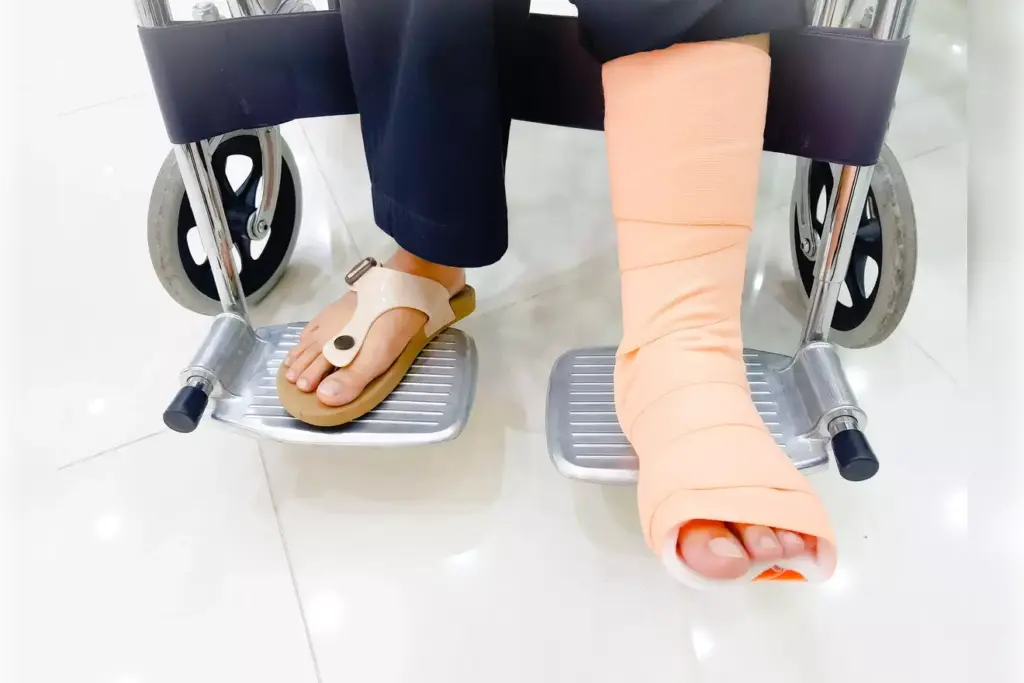 heal from bunion surgery