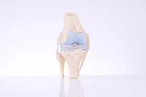 Cemented Knee Replacement: 7 Key Facts About Materials, Longevity, and Recovery