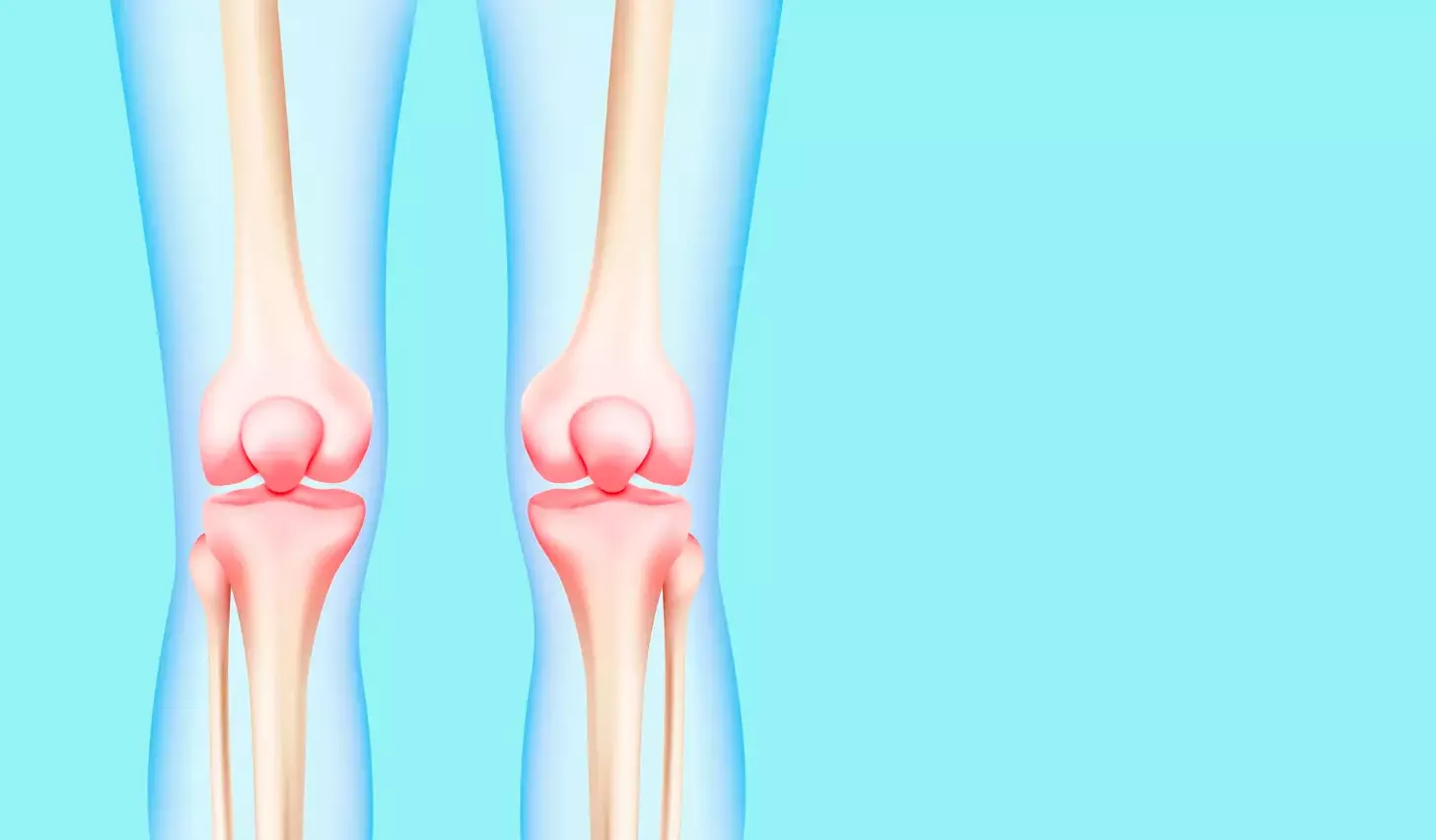Cemented Knee Arthroplasty: 9 Key Facts About Cemented vs Uncemented Replacement