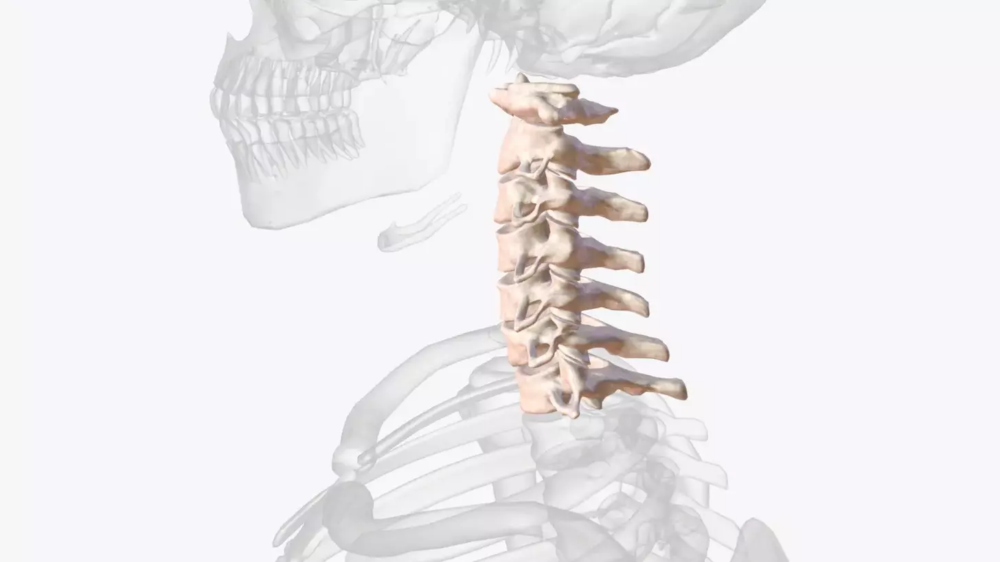 cervical spine fusion