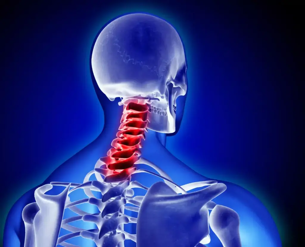 A detailed diagram showcasing the different levels of an ACDF (Anterior Cervical Discectomy and Fusion) surgery, rendered with medical accuracy and precision. The image depicts the spinal vertebrae, intervertebral discs, and the surgical approach, all presented in a clean, technical style against a neutral background. Lighting is soft and even, highlighting the anatomical details without harsh shadows. The camera angle provides a clear, unobstructed view, allowing the viewer to understand the surgical procedure and its variations. The overall mood is informative and educational, tailored to educate medical professionals and patients about this common neck fusion operation.