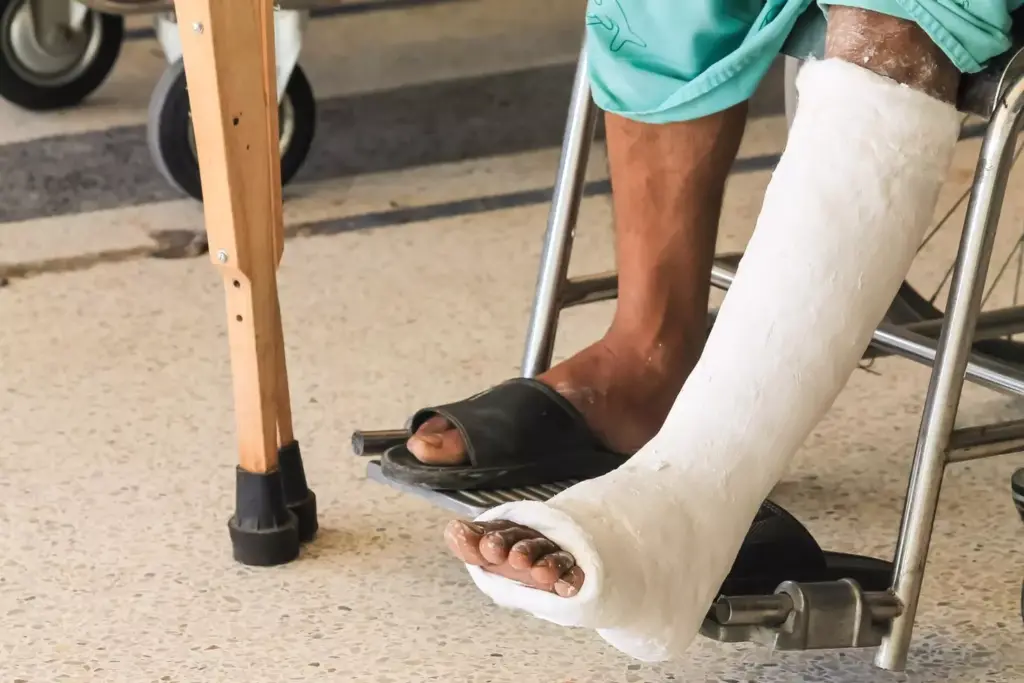 A detailed timeline depicting the recovery stages following an ACL surgical procedure. The foreground features a knee joint diagram with labeled anatomical structures, highlighting the ACL ligament. The middle ground showcases a series of timeline markers charting the progression of physical therapy, range of motion, and weight-bearing milestones over a 6-12 month period. The background is a clean, minimalist medical illustration style with a soft, soothing color palette to convey the healing process. Warm, directional lighting from the upper left casts subtle shadows, emphasizing the three-dimensional nature of the anatomy. The overall mood is informative, educational, and reassuring for patients undergoing ACL rehabilitation.