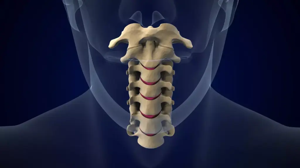 High-resolution, anatomically accurate 3D rendering of human cervical vertebrae in side profile, showing two fused vertebrae with clear visible fusion between the adjacent bones. Soft tissue and musculature visible, with a muted, neutral color palette. Crisp, high-contrast lighting from the left side casts dramatic shadows, highlighting the complex spinal structure. Rendered with a shallow depth of field to focus attention on the fusion site. Conveys a sense of clinical, medical detail and technical understanding of the subject.