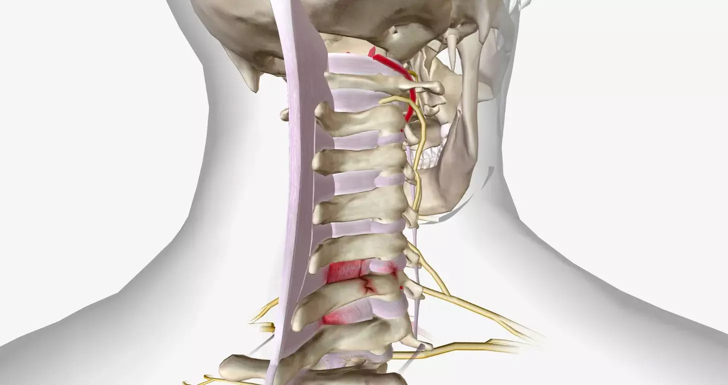 What Is Cervical Spinal Fusion Surgery and How Does It Work?