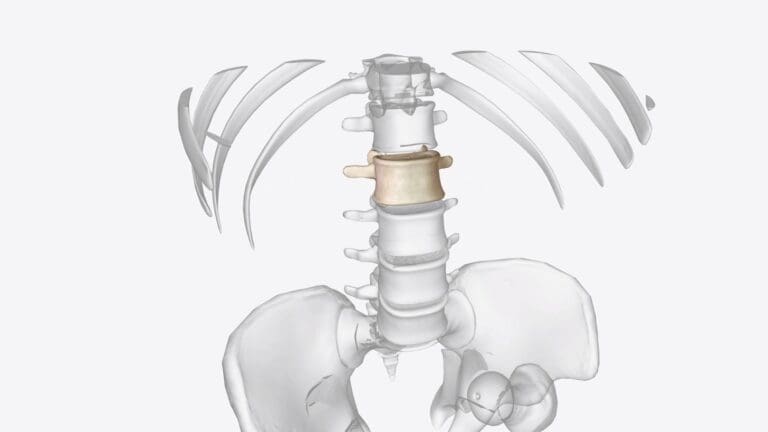 Spinal Autofusion Overview