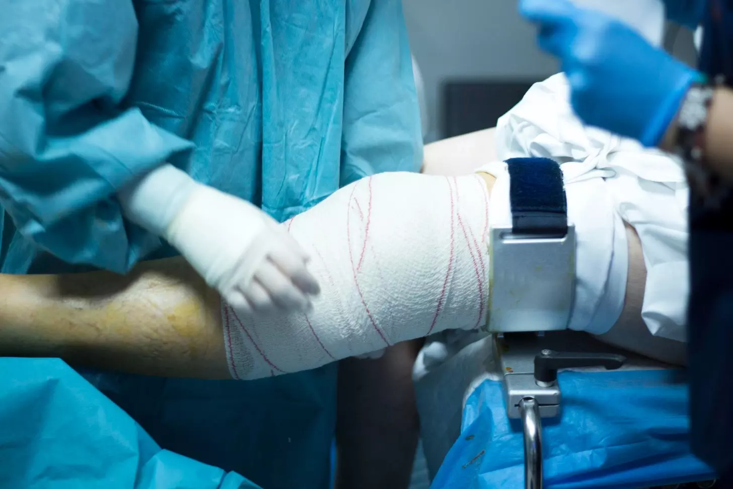 ACL Surgery: 10 Key Facts on Grafting, Repair, and Reconstruction 1 ACL Surgery: 10 Key Facts on Grafting, Repair, and Reconstruction