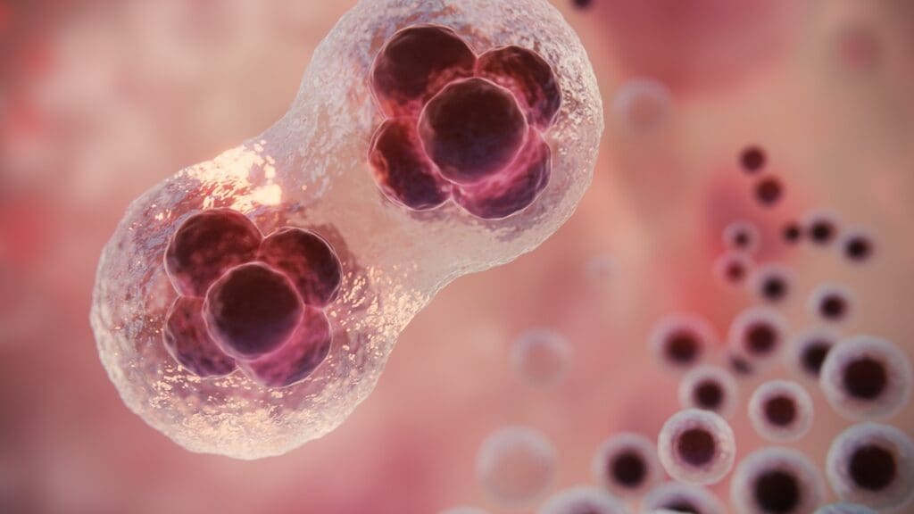 What Happens When Prostate Cancer Comes Back After Treatment?