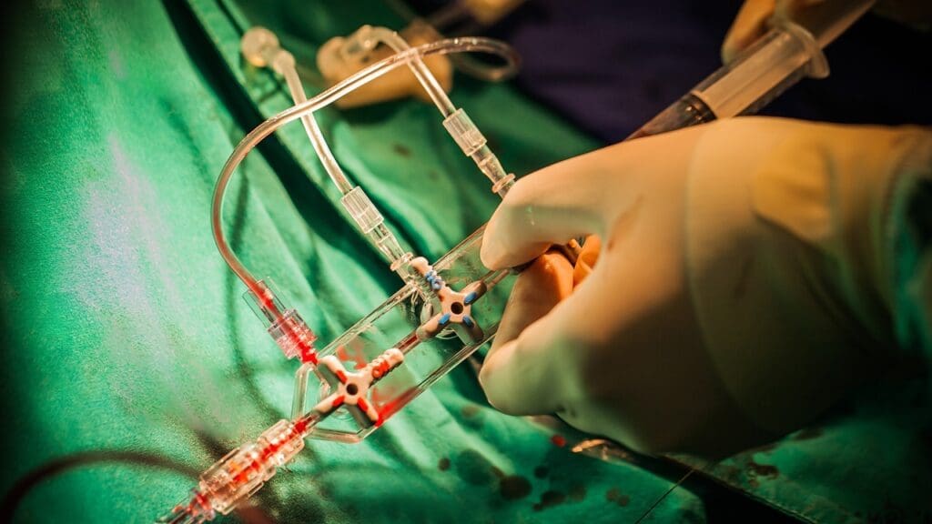 Catheter After Prostatectomy Surgery