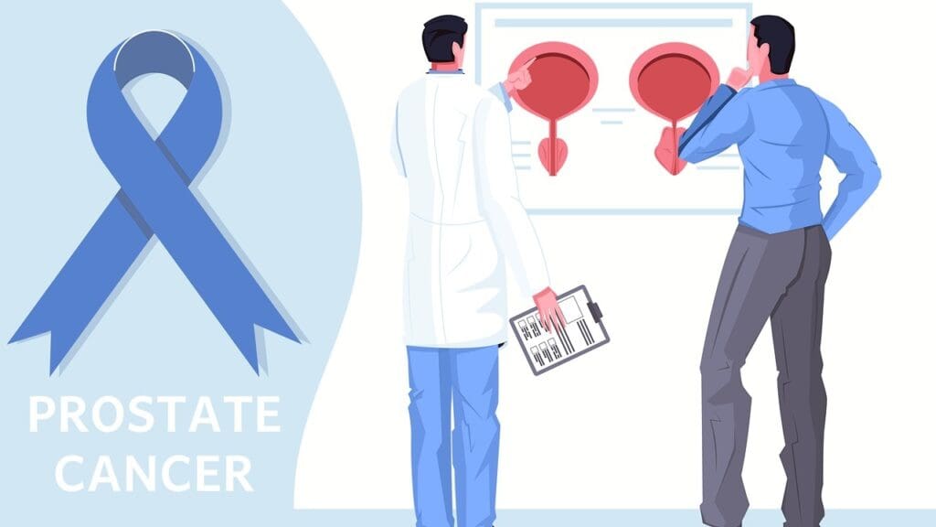 7 Proven Treatment Options for Recurrent Prostate Cancer After Surgery or Radiation