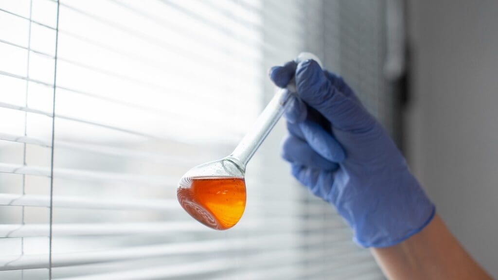 bloody urine after prostatectomy bloody urine after prostatectomy