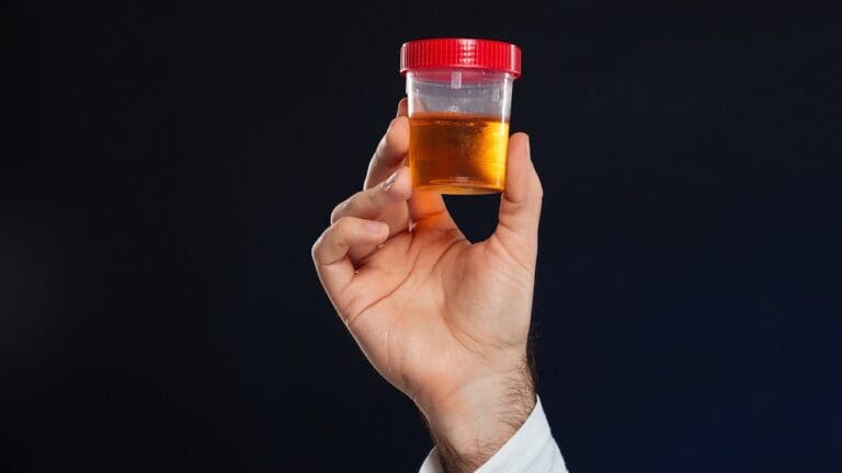 Bloody Urine After Prostatectomy: 7 Key Facts and What to Expect