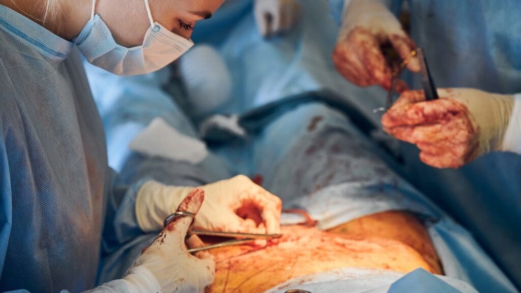 bleeding after green light laser surgery bleeding after green light laser surgery