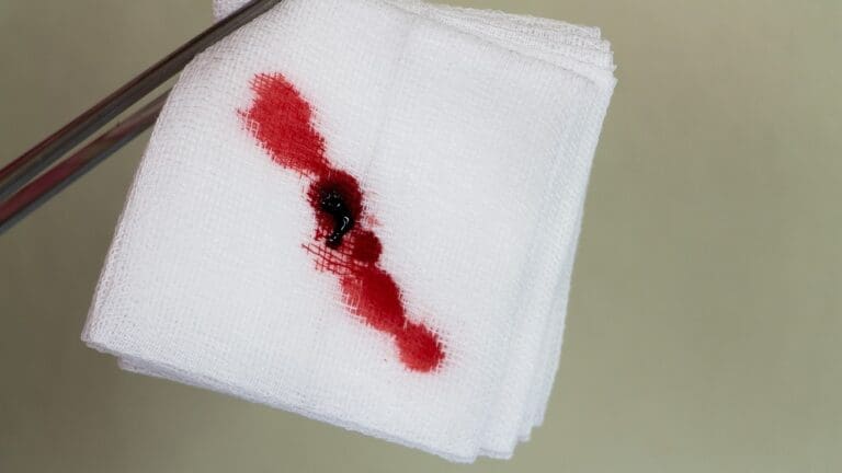 How Long Do Blood Clots and Bleeding Last After Green Light Laser Prostate Surgery?