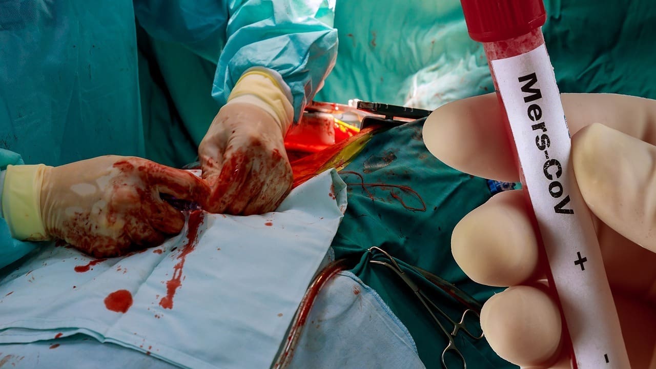 How Long Do You Bleed After Green Light Laser Surgery and What Is Recovery Like?