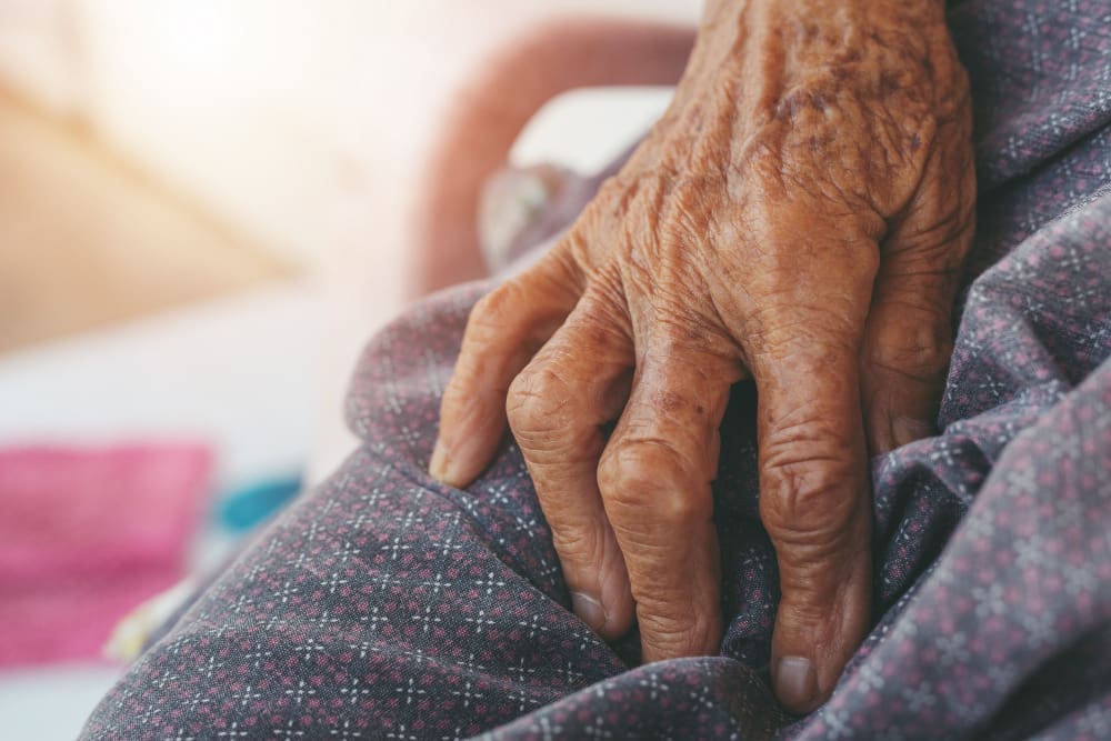 arthritis in knee 4 LIV Hospital