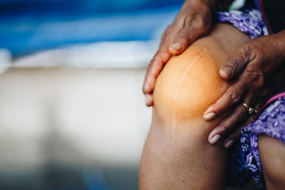 knee pain 21 LIV Hospital