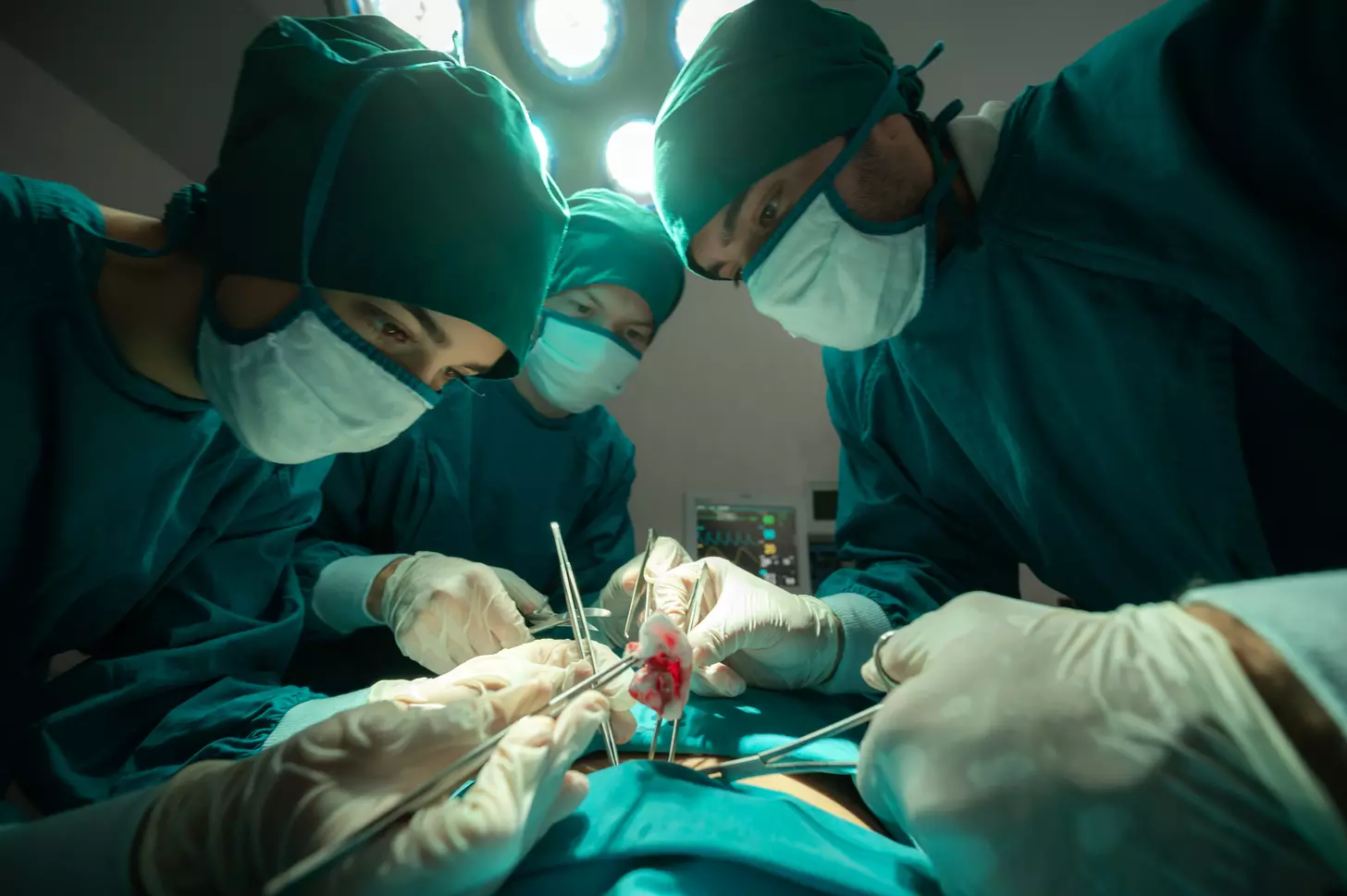 What Is a Quintuple (Five-Vessel) Bypass and How Successful Is the Surgery?