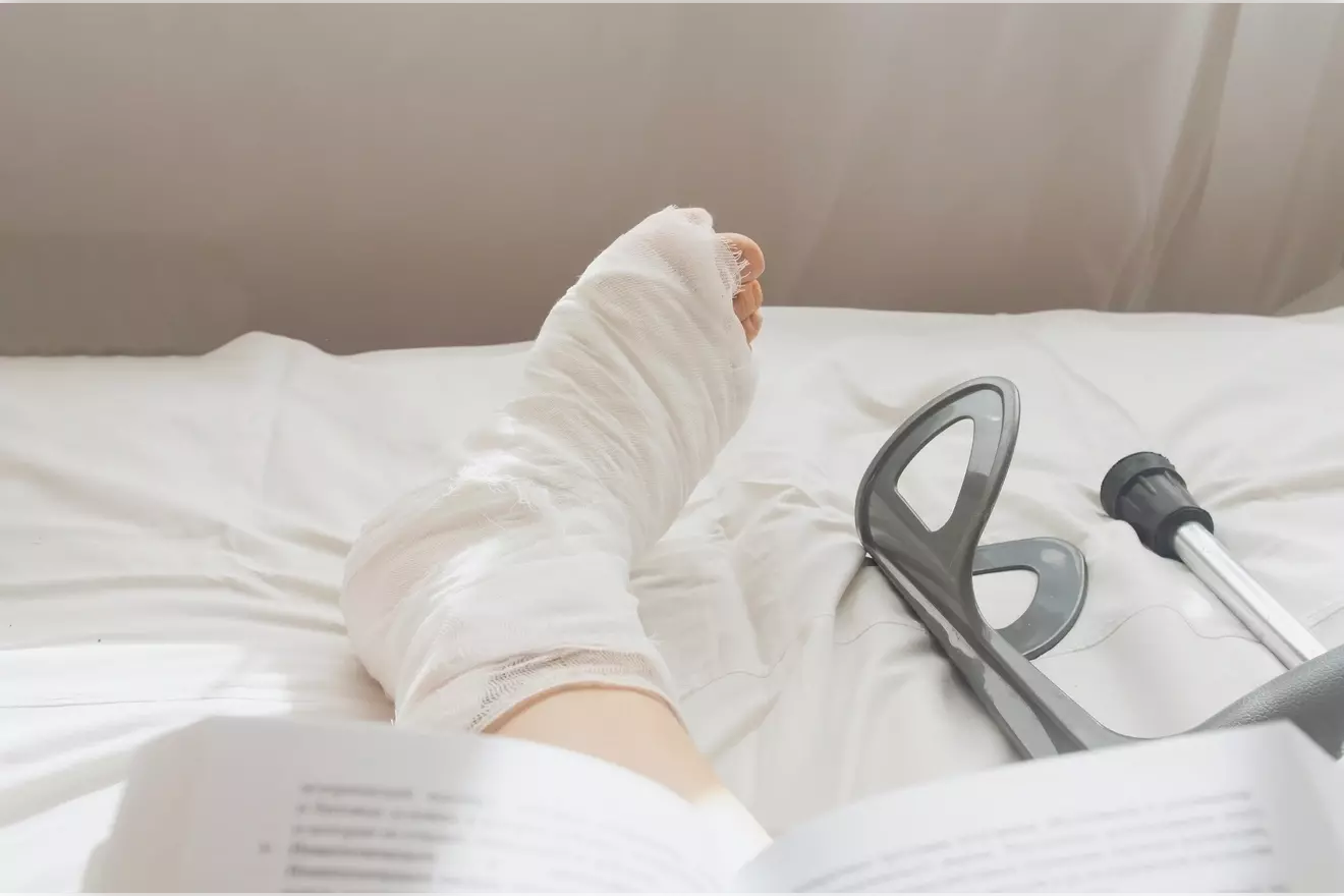 Bunion Surgery Healing Time: 7 Key Facts on Minimally Invasive Recovery