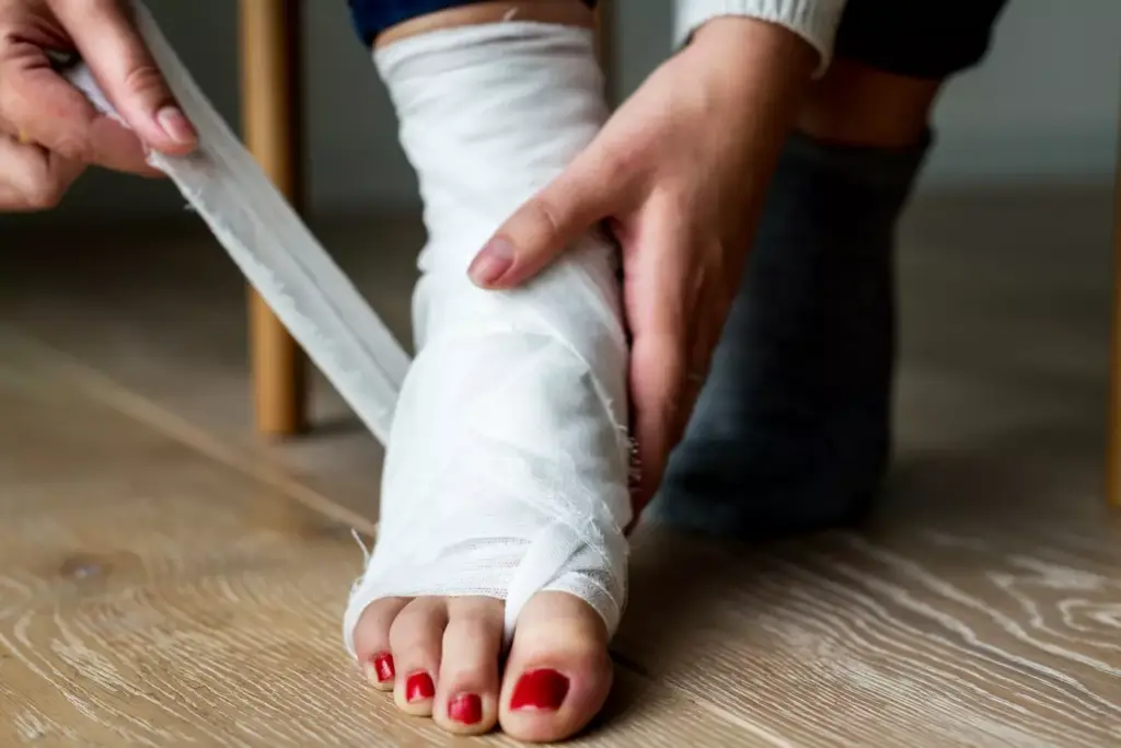 recover from bunion surgery