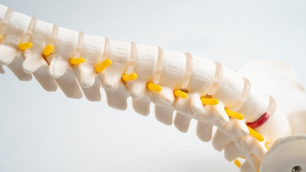 compression fracture of lumbar spine