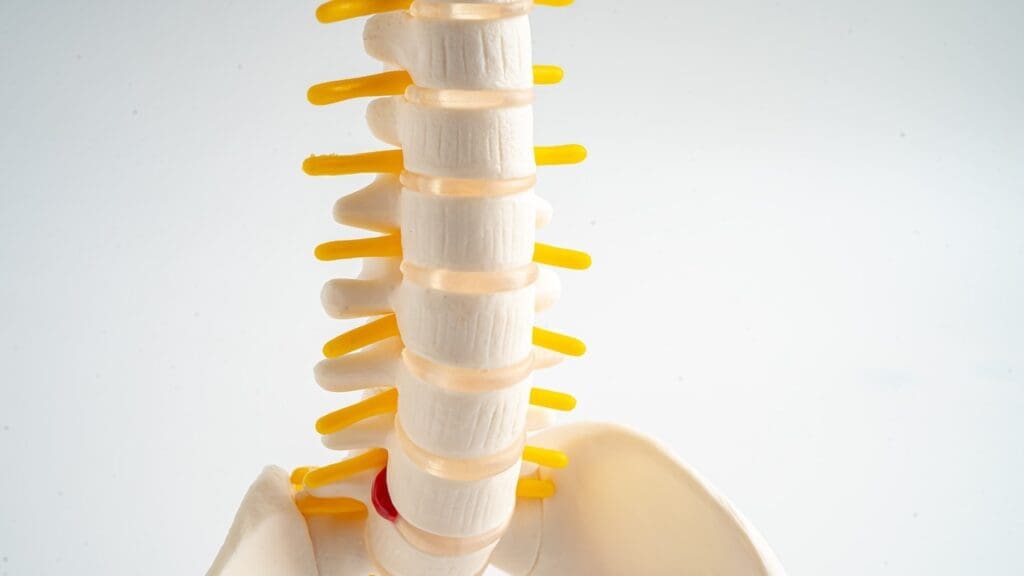 L1 and L2 spine compression fractures