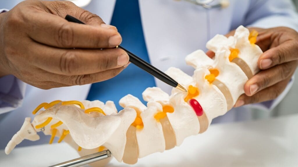 spinal fusion lumbar