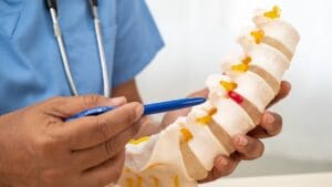 Spinal Fusion Surgery: 7 Key Facts, Indications, and Imaging Insights