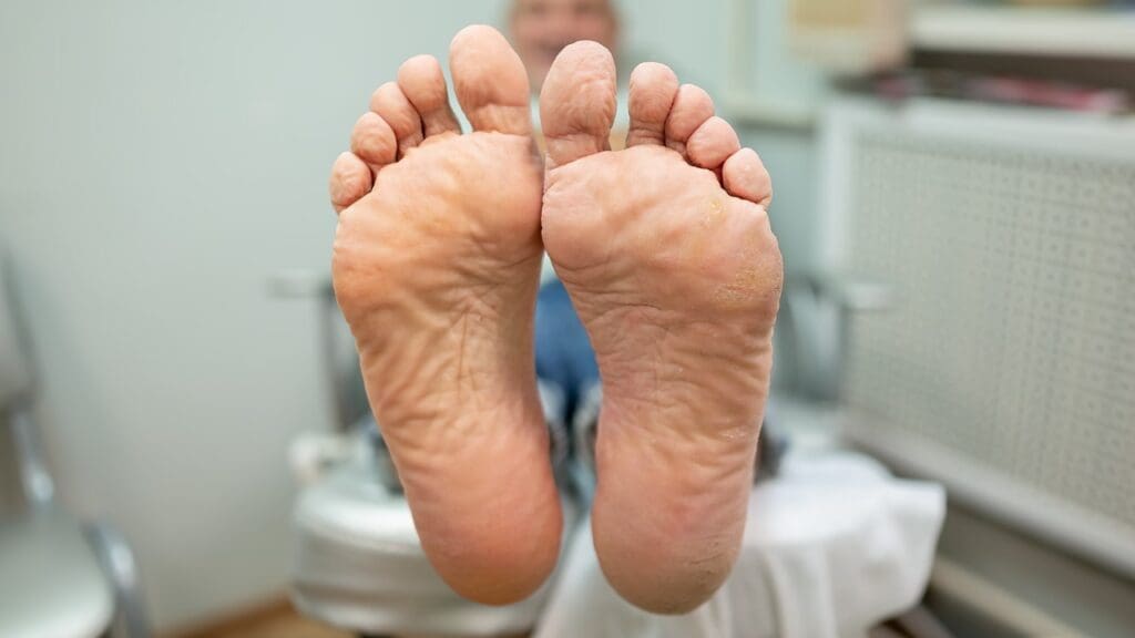 cold feet after knee surgery cold feet after knee surgery