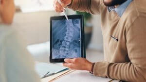 Common Problems After Spinal Fusion: 12 Key Issues and Symptoms Explained