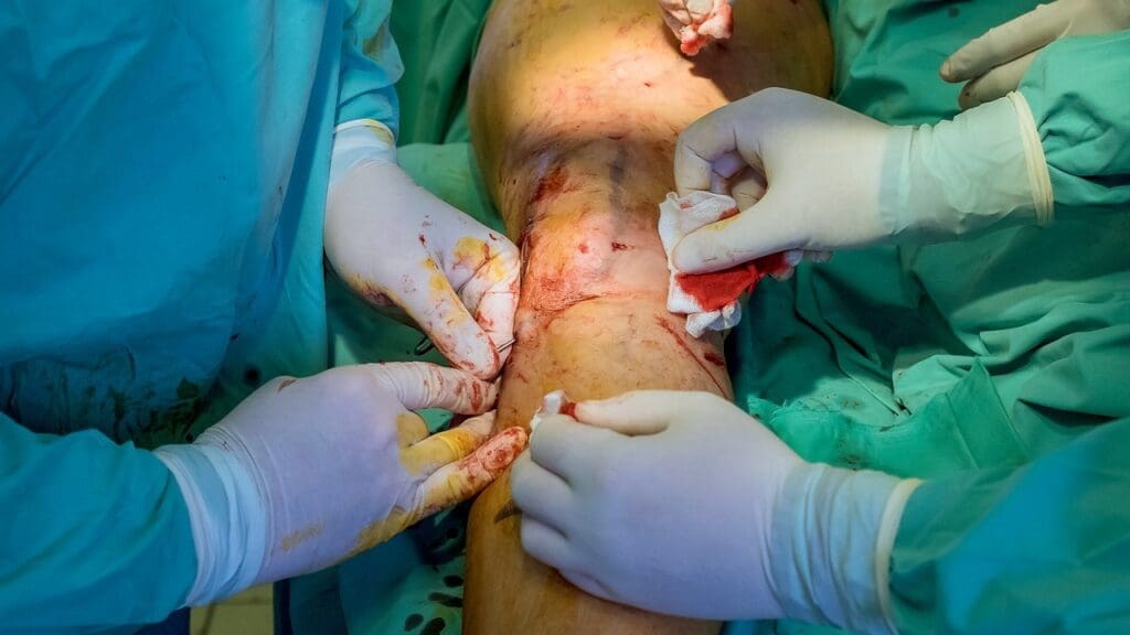 knee arthroscopy procedure knee arthroscopy procedure