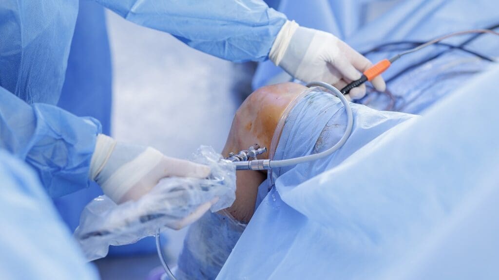 Cobalt Chrome vs Titanium Knee Replacement Cobalt Chrome vs Titanium Knee Replacement