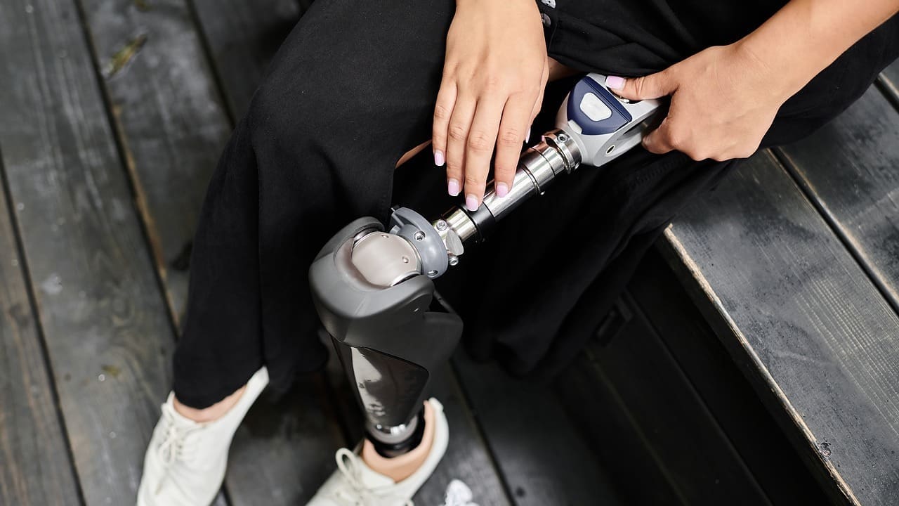 Titanium Knee Prosthesis: 10 Essential Facts on Total Knee Replacement and TKA