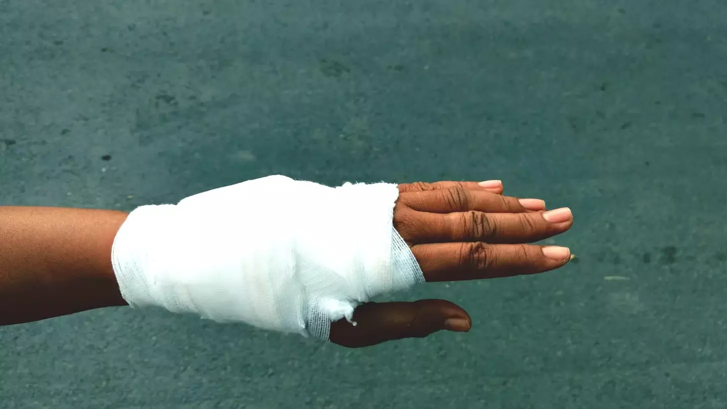 When Is Carpal Tunnel Bad Enough for Surgery? Key Signs and What to Consider