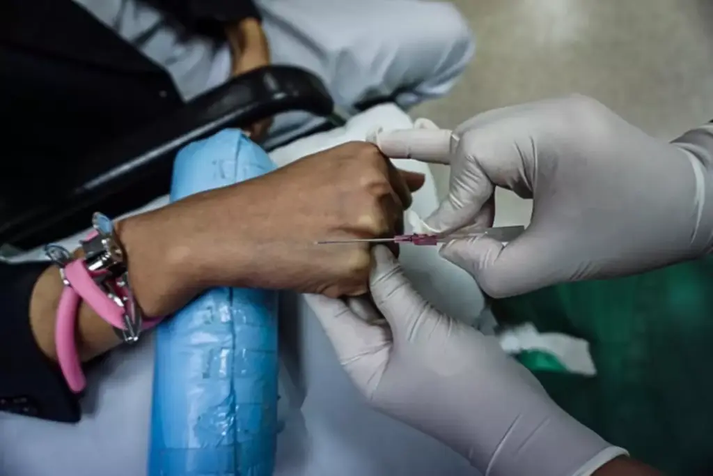 A close-up view of a surgeon's hands performing a carpal tunnel release procedure. The patient's wrist is clearly visible, with the skin incision exposing the transverse carpal ligament. The surgeon's gloved fingers gently retract the tissue, revealing the median nerve and allowing for the careful division of the ligament. Bright surgical lighting casts a warm, focused glow on the operating field, creating a sense of precision and concentration. The composition emphasizes the intricate details of the delicate surgery, conveying the technical expertise required to alleviate the painful symptoms of carpal tunnel syndrome.