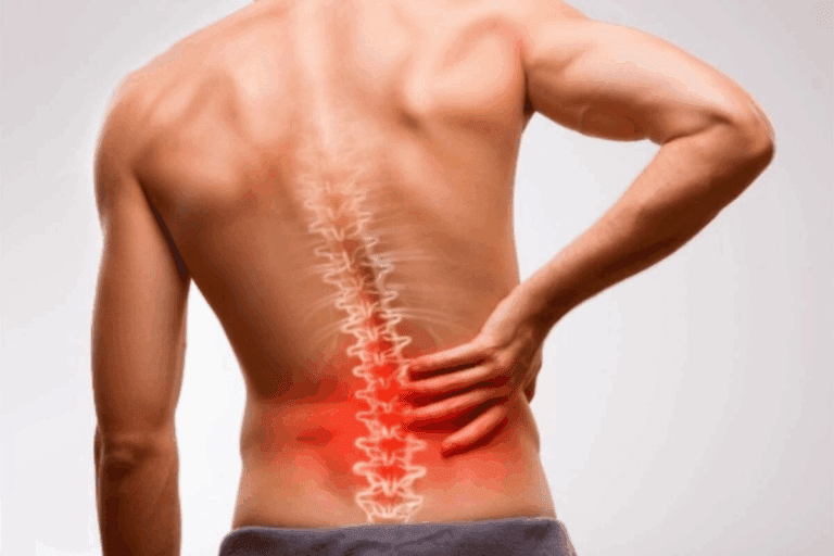 Understanding Spinal Stenosis Hip Pain and Its Causes