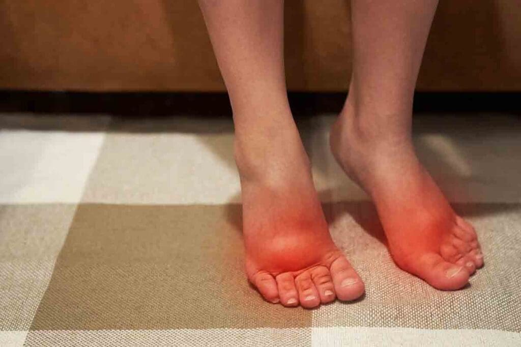 Anemia Leg Swelling: Crucial Causes of Edema Explained 2 Anemia Leg Swelling: Crucial Causes of Edema Explained