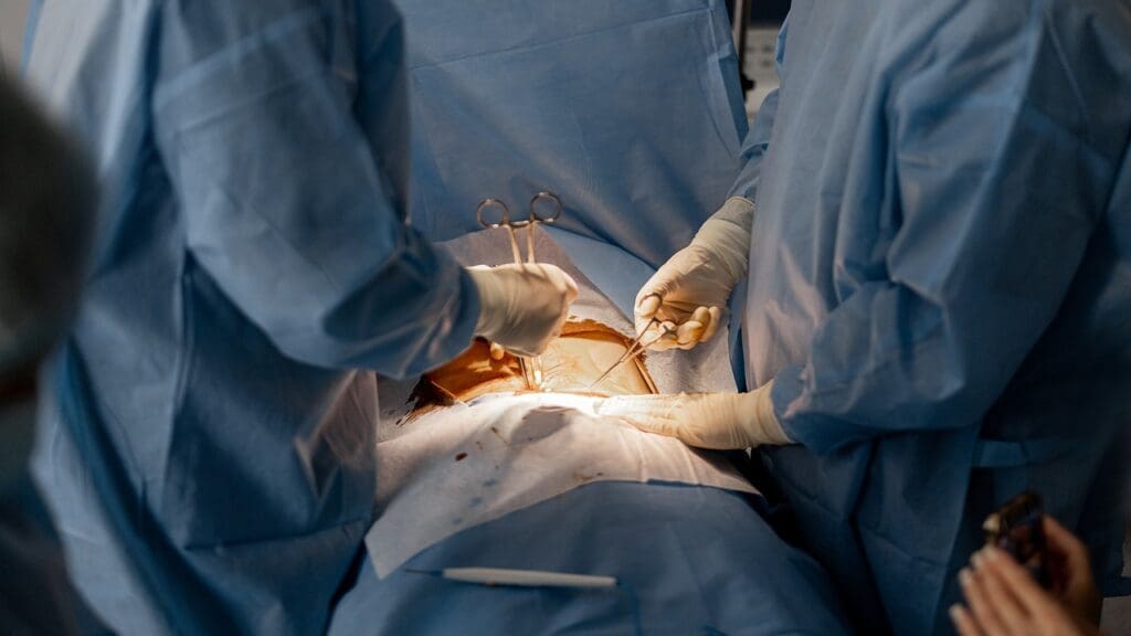 arthroscopic surgery arthroscopic surgery
