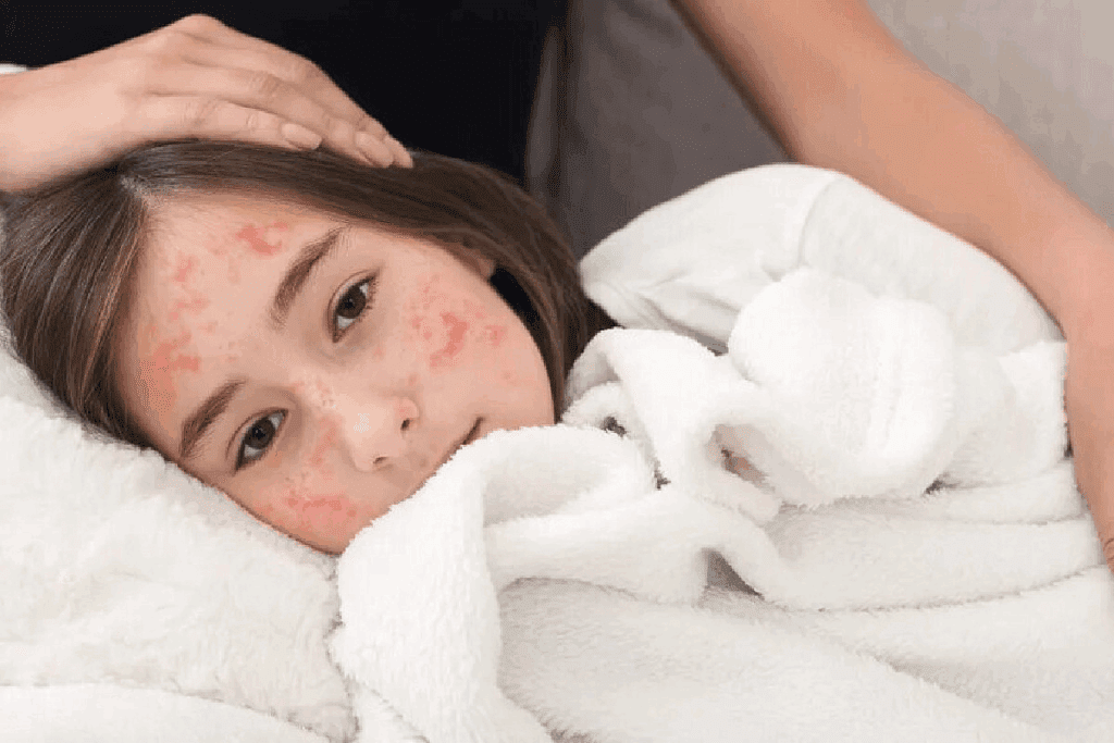 8 Key Signs Of Anemia In Children: Spot Symptoms Early